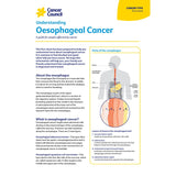 Understanding Oesophageal Cancer (Digital PDF)