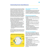 Understanding Ocular Melanoma (PDF Download)