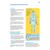 Understanding Secondary Bone Cancer (PDF Download)